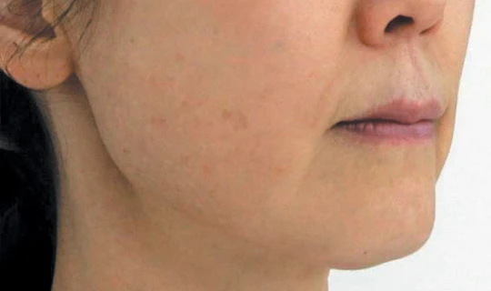 Oligio — Клиника эстетической медицины RE:new