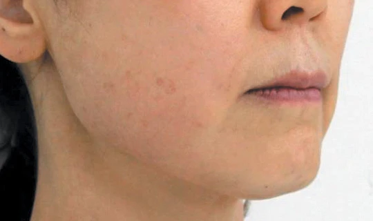 Oligio — Клиника эстетической медицины RE:new