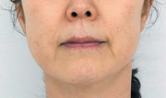 Oligio — Клиника эстетической медицины RE:new