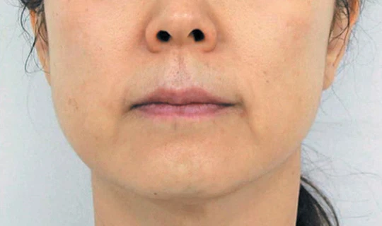 Oligio — Клиника эстетической медицины RE:new