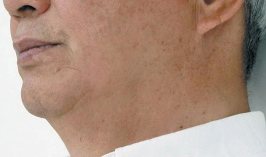 Oligio — Клиника эстетической медицины RE:new