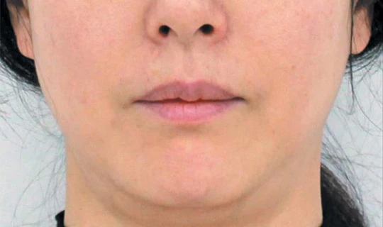 Oligio — Клиника эстетической медицины RE:new