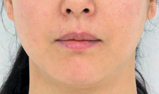 Oligio — Клиника эстетической медицины RE:new